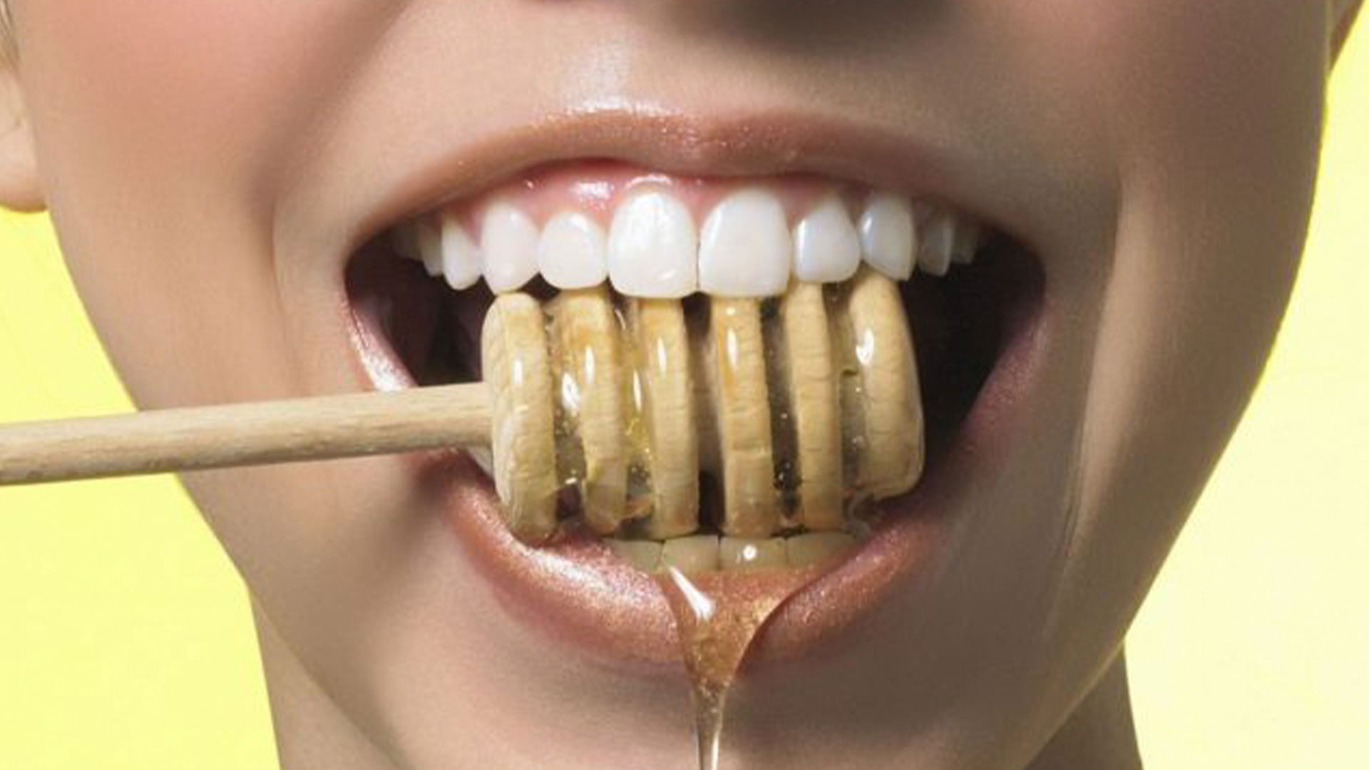 miel y microbiota periodontal